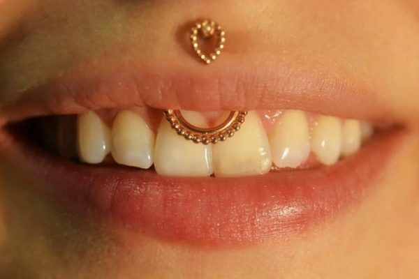 По данным стоматолога, пирсинг может привести к рецессии десны и даже онкологическим рискам